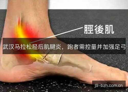 武汉马拉松胫后肌腱炎，跑者需控量并加强足弓